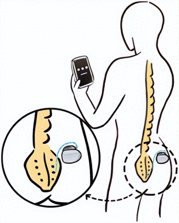 medias-uploads/ty-202503/45cd3078a6ee8904af9bcd9d10d34efa.png