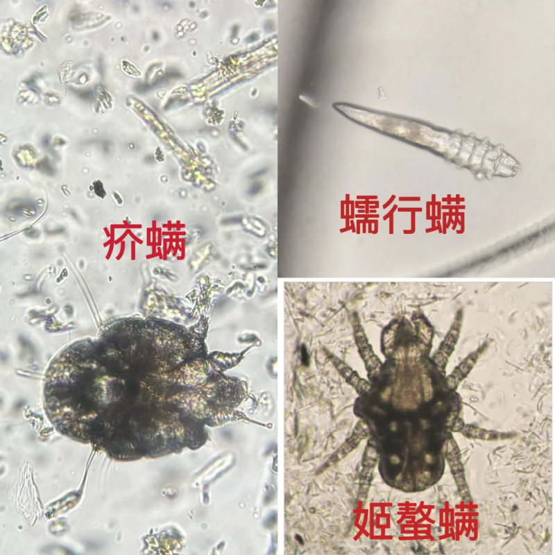 家居健康防护指南：专业除螨仪精选与使用攻略