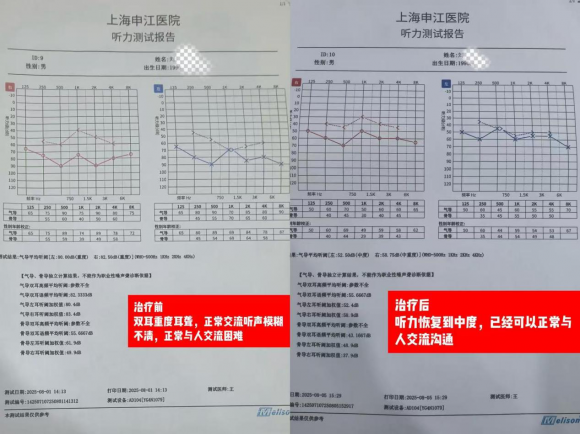 上海申江医院好不好？耳神经激活靶向植入治疗守护听力健康