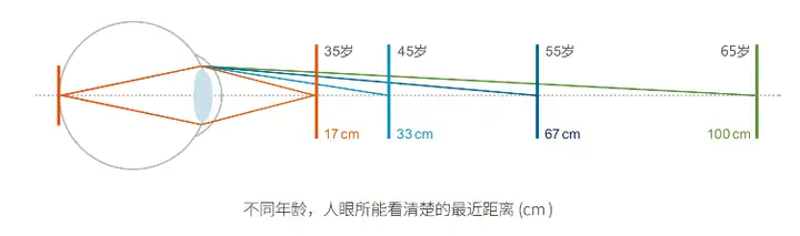 华德眼科|40+近视又老花，摘不掉眼镜还总得换？迈可视老视矫正新选择