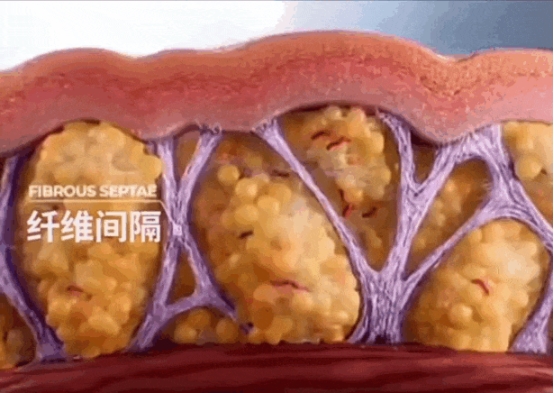 春季塑形季，局部脂肪怎么改善更高效？杏林吸脂